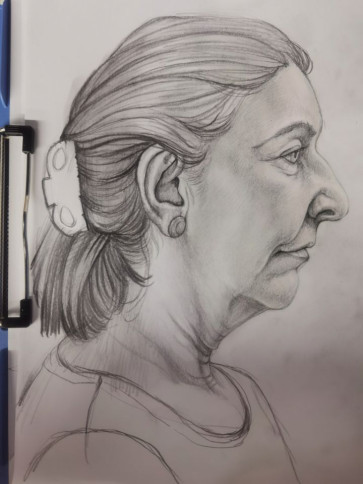 25 — figure reference